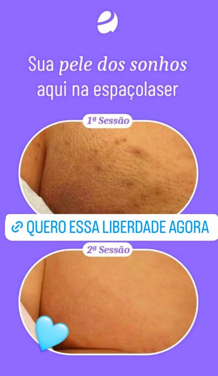 Imagem do WhatsApp de 2025-04-07 à(s) 10.27.36_4a3e2487